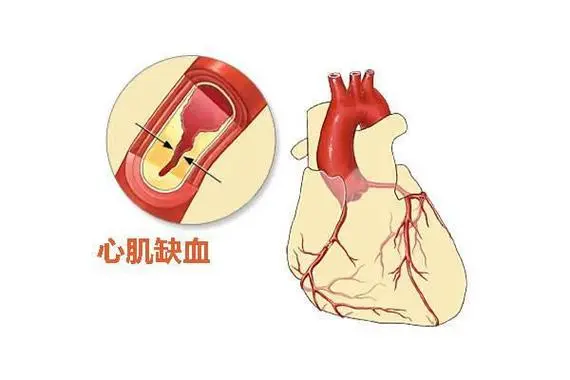 "年轻不是护身符！30岁后这5个习惯正在‘饿死’你的心脏"